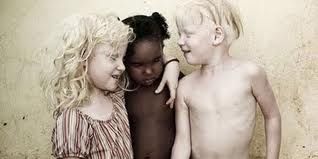 Ada Apa dengan Kulit Hitam?