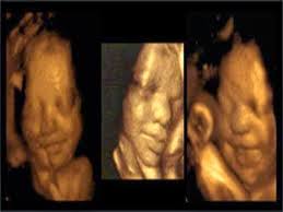 Fakta Quran : Janin pun Bisa Tertawa dan Menangis