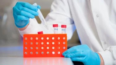 Apa Itu Covid-19? Gausah Panik, Ini Ulasan Menarik Seorang Expert