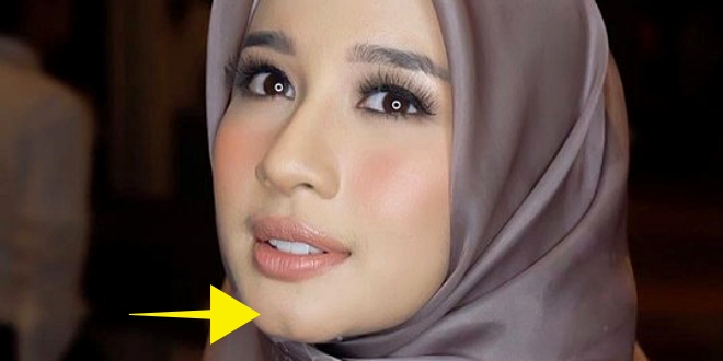 Inilah 15 Fitur Tubuh Langka, Ada Yang Cuma Dimiliki 40 Orang! Anda Termasuk?