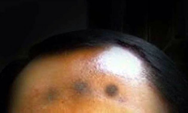 Bekas Sujud, Bukan Sekadar Hitamnya Jidat