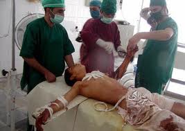 Nato Menewakan 2 Anak Afghanistan