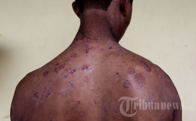 Penganiayaan dan Perbudakkan oleh Centeng Pabrik Yang Mengerikan