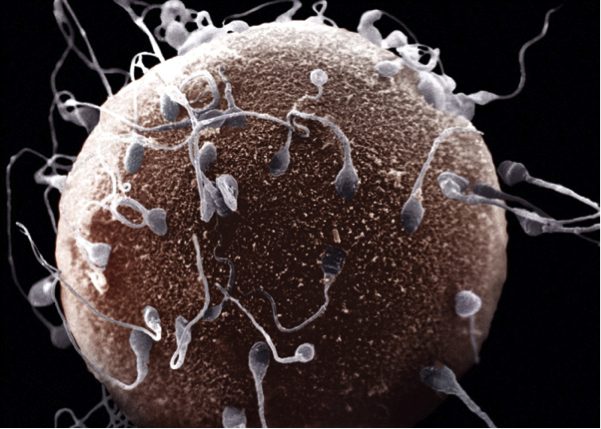 Embriologi Menurut Quran dan Sunnah Bagian ke 2