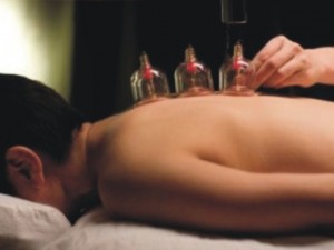 Terapi Bekam, Trend Baru Seleb Hollywood