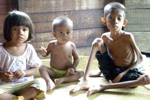 Di Nusa Tenggara Timur Ada 21.134 Bayi Menderita Kurang Gizi