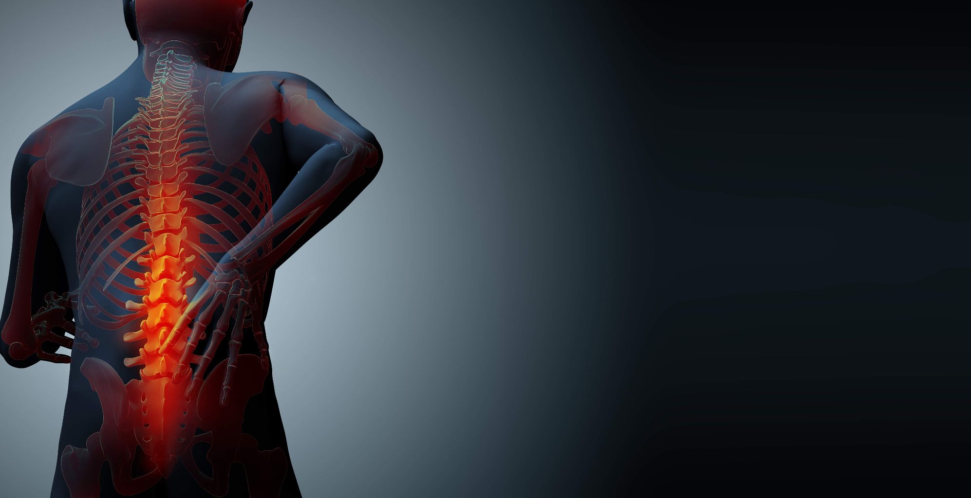 Osteoporosis Bukanlah Penyakit Kekurangan Kalsium