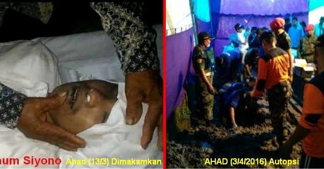 Kesaksian Penggali Makam dan Dokter: Jasad Siyono Masih Utuh dan Tidak Berbau