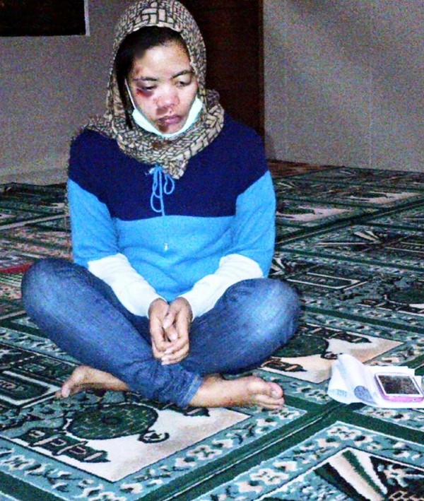 muslimah luka