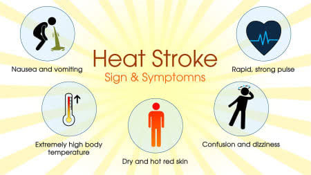 Ini Tips Mencegah Heatstroke saat Ibadah Haji