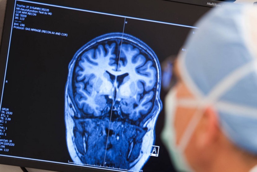 Gejala Epilepsi dan Pengobatannya Menurut Ibnu Sina