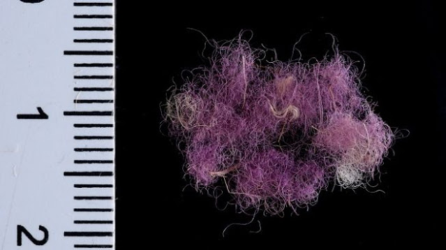 Peneliti Palestina: Kain Ungu Berusia 3.000 Tahun Diduga Dipakai Raja Daud dan Sulaiman