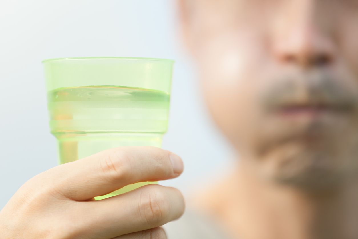 Sunnah Rasulullah SAW untuk Berkumur Usai Minum Susu