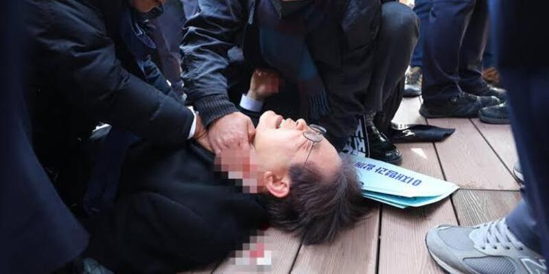Ditikam, Bagian Leher Pemimpin Oposisi Korea Selatan Robek