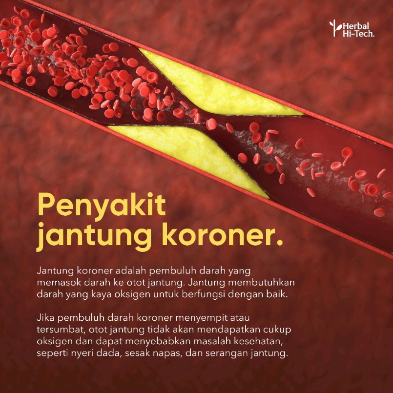 MENGOBATI MASALAH JANTUNG KORONER DENGAN BAHAN ALAMI