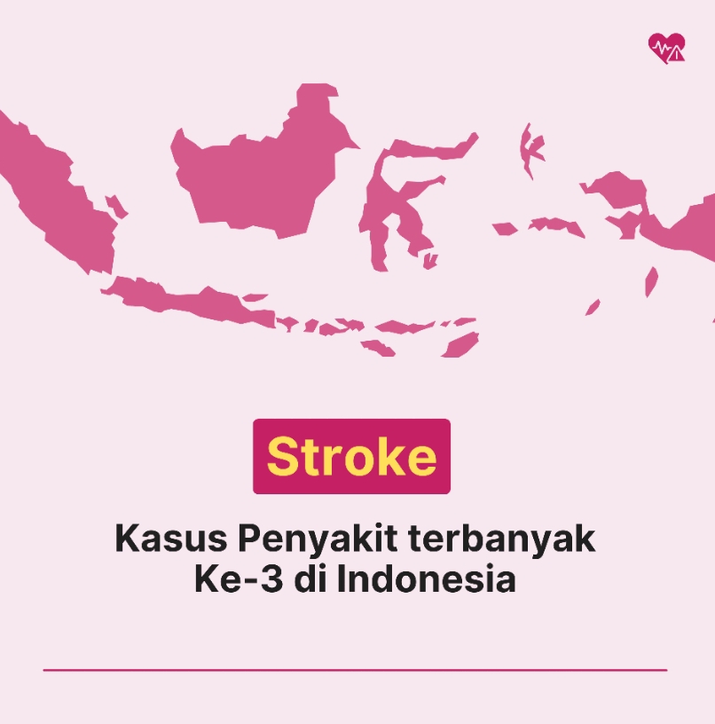 SOLUSI ALAMI PENCEGAHAN DAN PENGOBATAN STROKE