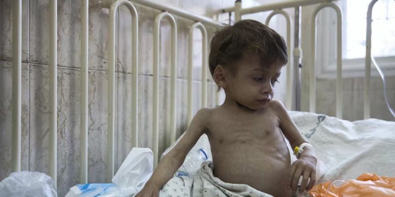 UNICEF: 90 Persen Anak Gaza Kekurangan Gizi Parah
