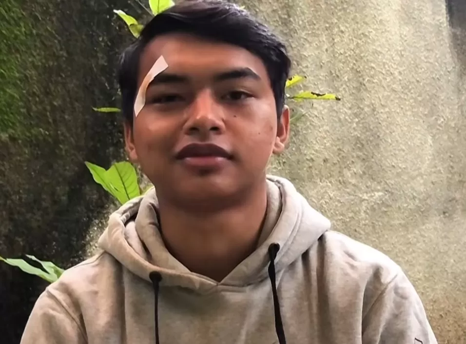 Viral Presiden BEMKM UNNES Alami Kekerasan Saat Demo Tolak RUU TNI: Kepala Berdarah, Nyaris Diculik