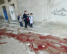 Trauma Anak-Anak Palestina, "Ayah, Israel Telah Membunuh Memo... "