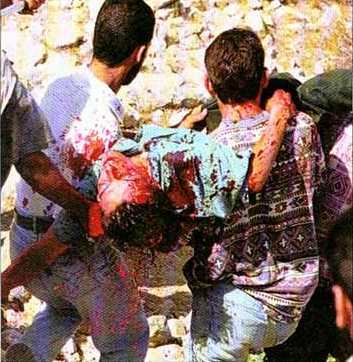  Hari Kedua, 280 Penduduk Palestina Tewas 