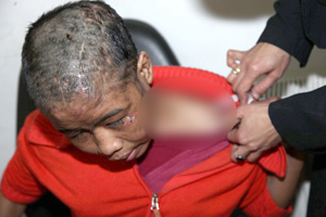 TKW Indonesia di Yordania Kembali Menjadi Korban Penyiksaan