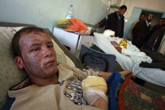 Pengakuan Dua Dokter Norwegia Tentang Kekejian Israel di Jalur Gaza