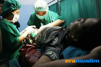 Fatwa "Halal" Vasektomi dari MUI Disambut Gembira BKKBN