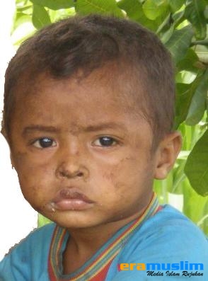 Anak Suka Bengong